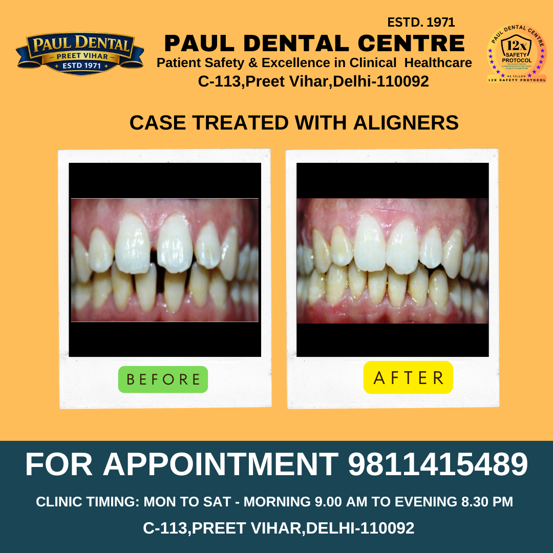 Case 30 – Paul Dental Center