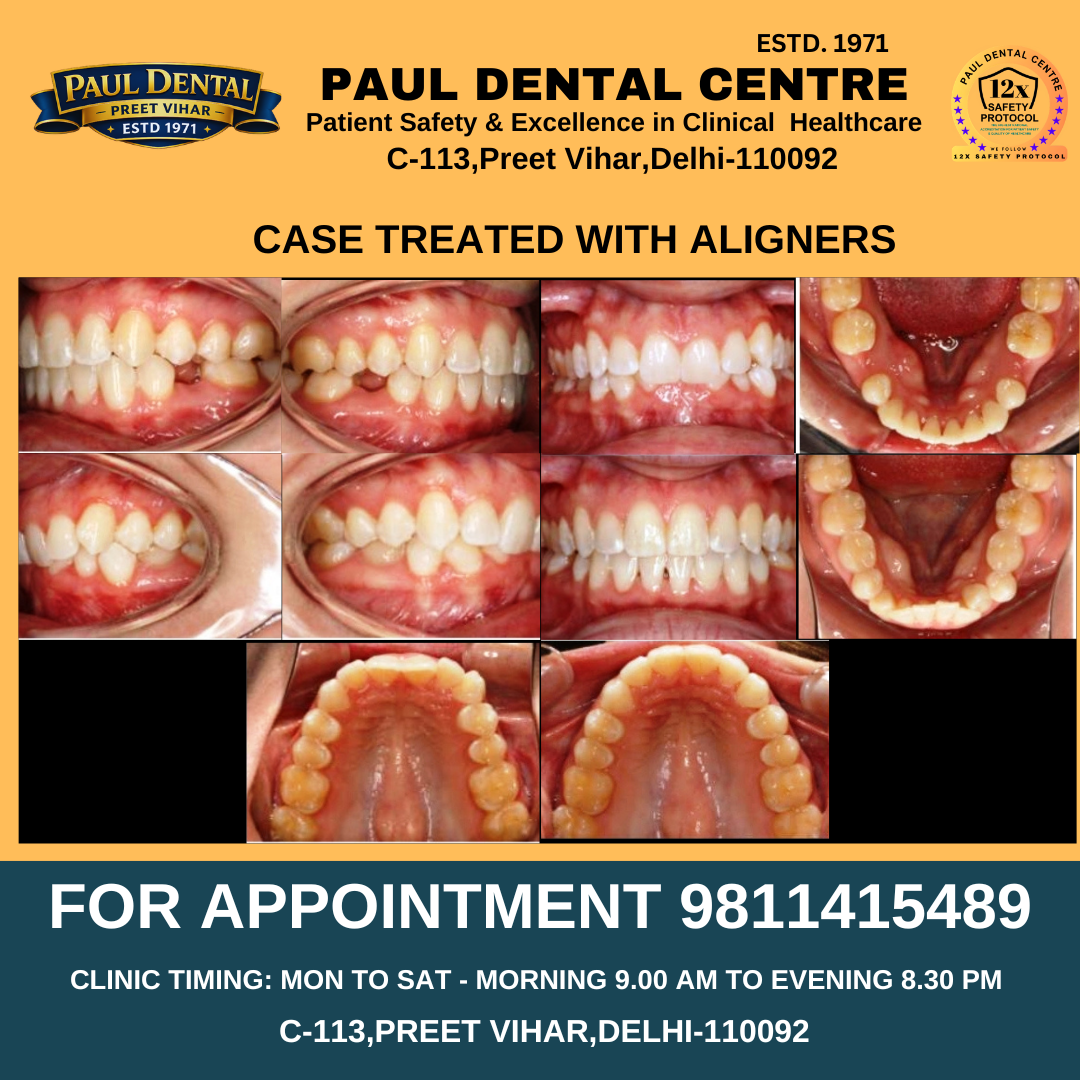 Case 31 – Paul Dental Center