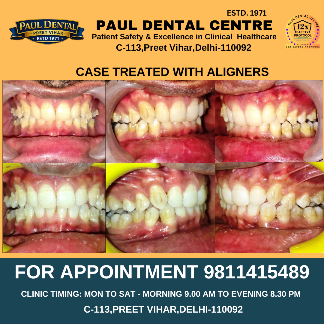 Case 33 – Paul Dental Center