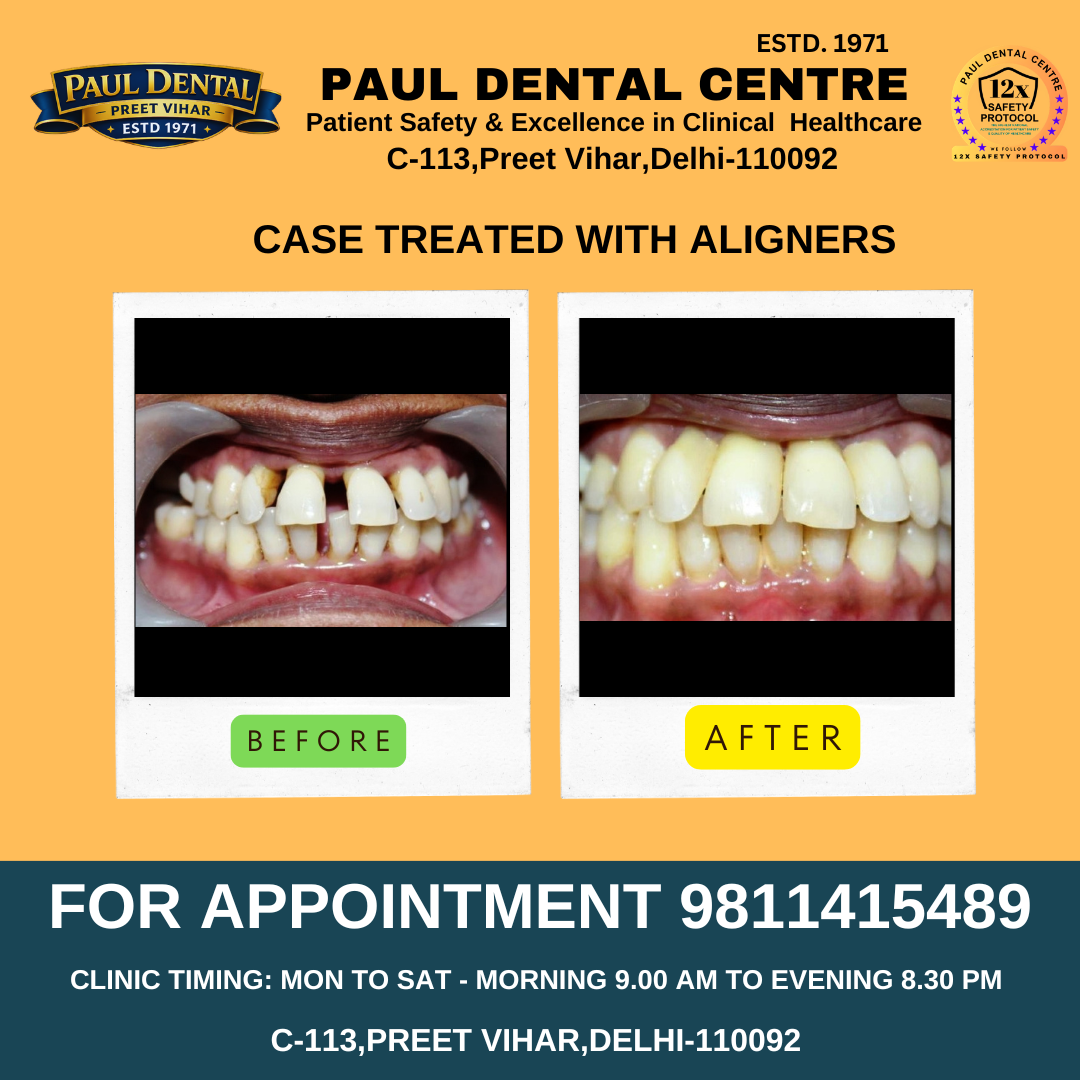 Case 34 – Paul Dental Center