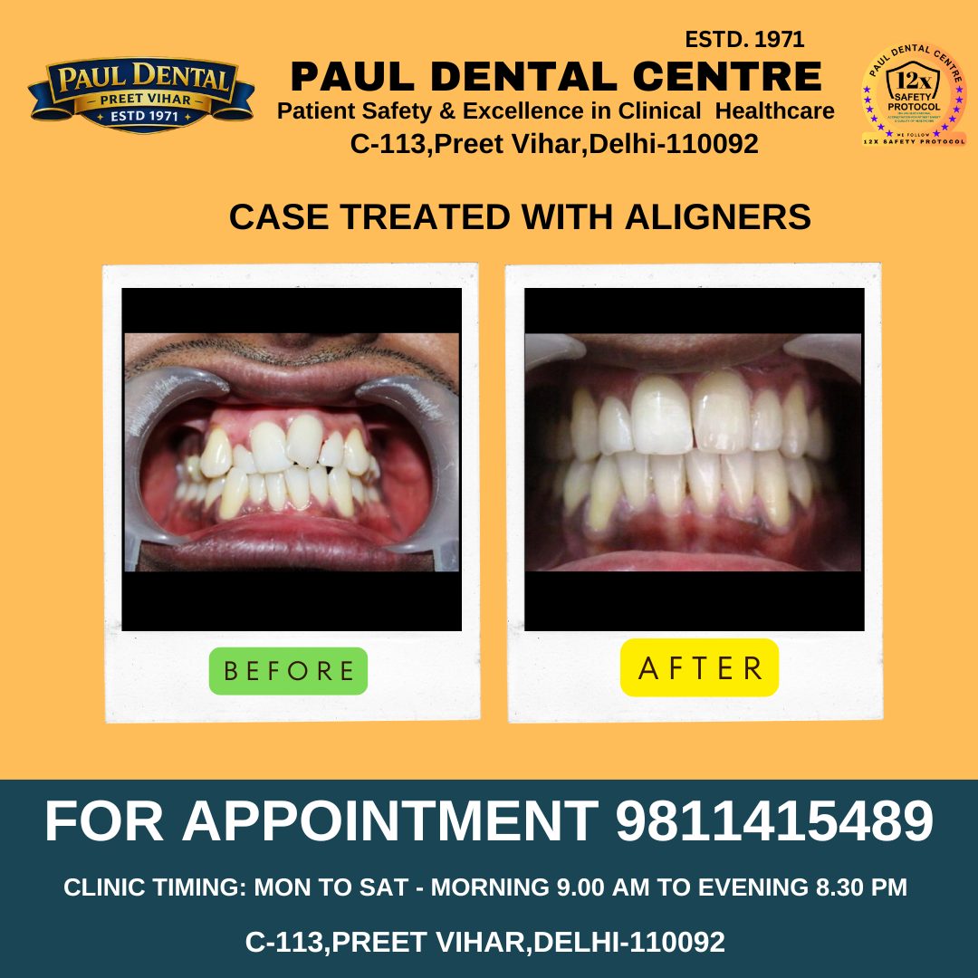 Case 35 – Paul Dental Center