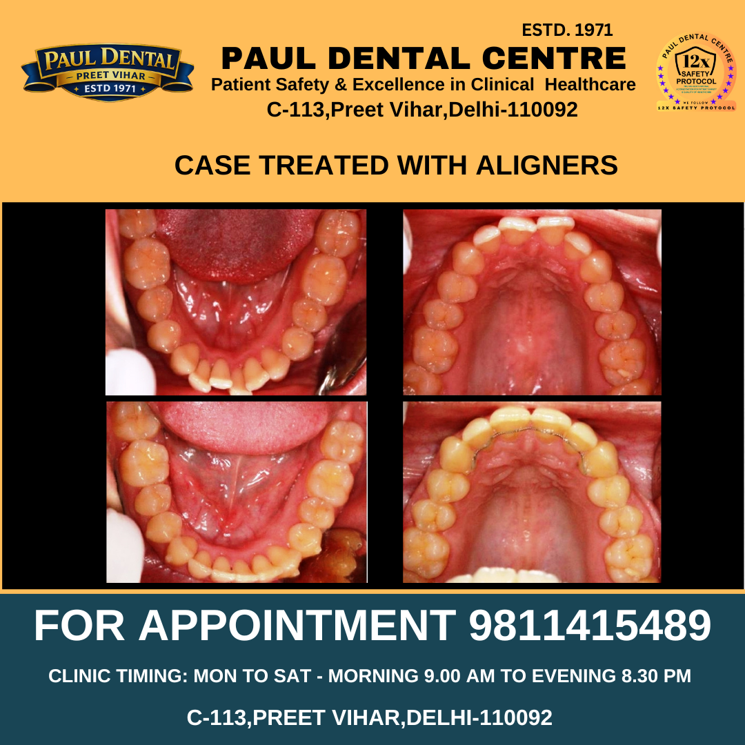 Case 37 – Paul Dental Center
