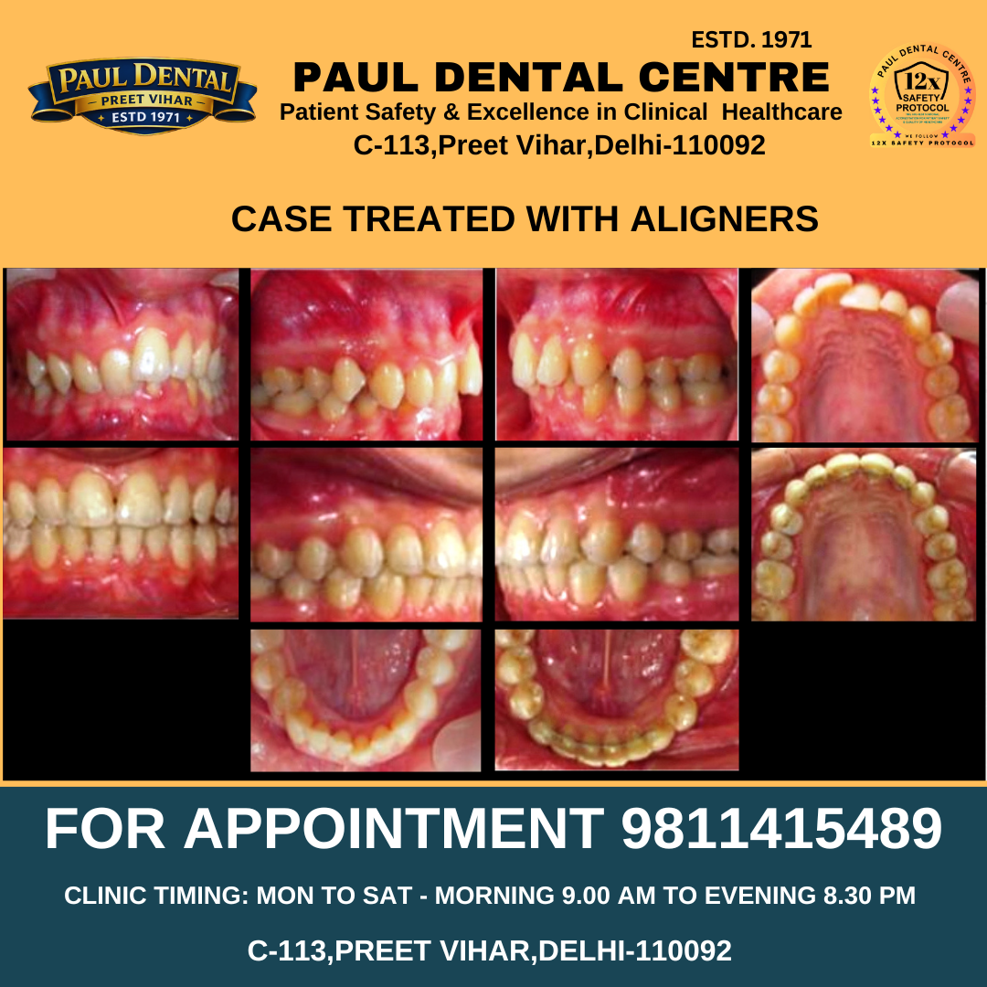 Case 38 – Paul Dental Center